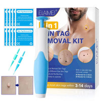 Skin Tag & Mole Removal Kit