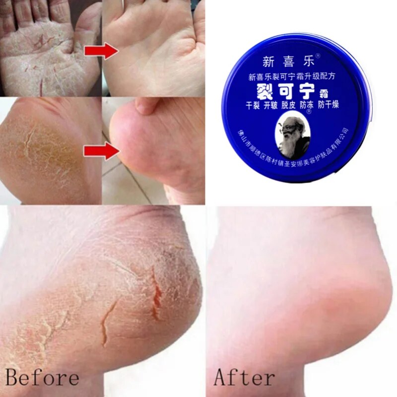 Heel Repair Cream