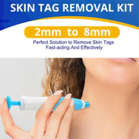 Skin Tag & Mole Removal Kit