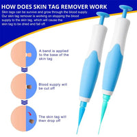 Skin Tag & Mole Removal Kit